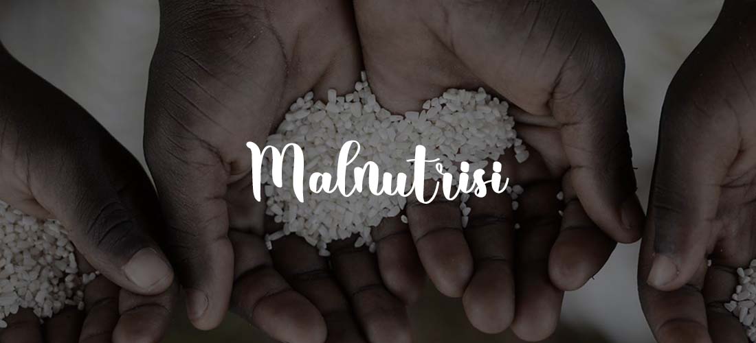 malnutrisi+adalah
